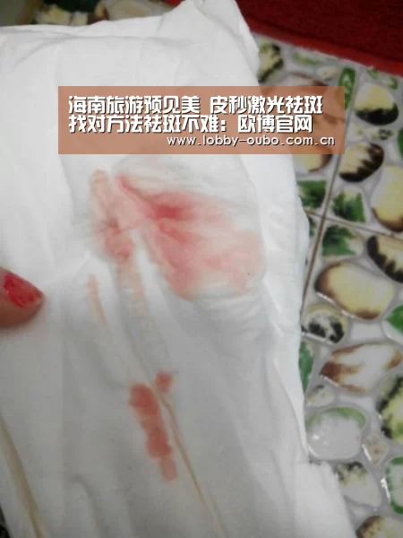 海南旅游预见美 皮秒激光祛斑 找对方法祛斑不难：欧博官网